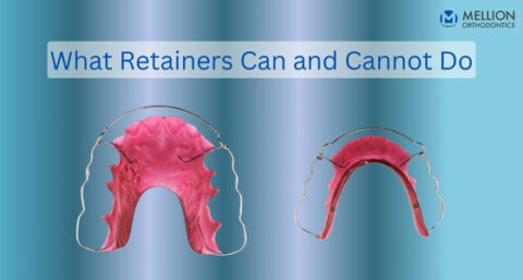 My Teeth Have Shifted! Can my Retainers Correct the Slight Shift?