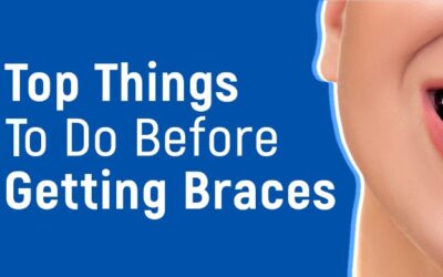 Top Things To Do Before Getting Braces