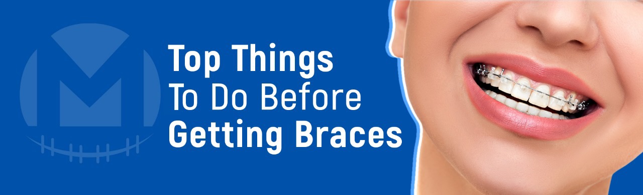 Top Things to Do Before Getting Braces