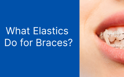 What Elastics Do for Braces? The Key to a Straighter Smile